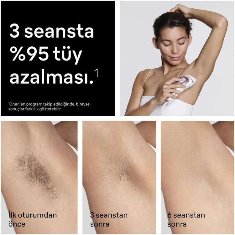 دستگاه لیزر موهای زائد صورت و بدن Braun آلمان مدل PL7432