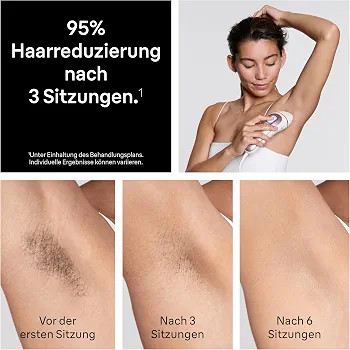 لیزر موهای زائد با فناوری IPL برند Braun سری Skin i·expert مدل PL7431