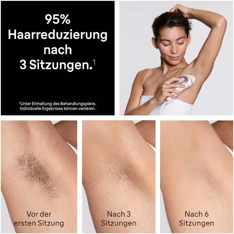 دستگاه لیزر موهای زائد برند Braun آلمان سری IPL Skin i·expert مدل PL7321